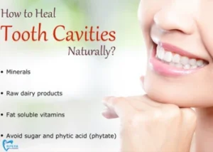 How to Heal Dental Cavitations Naturally