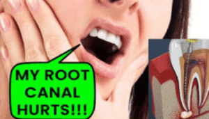 Why Does Root Canal Tooth Hurts with Pressure? Best Solution