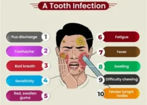 Symptoms of a Tooth Infection