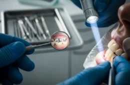 Teeth and Fillings: Common Problems, Pain, and When to See a Dentist