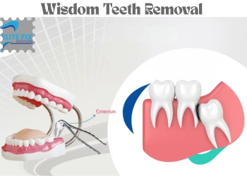 Wisdom Teeth Removal Cost