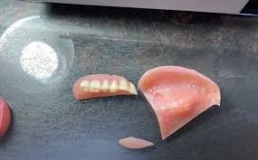 Don't Panic! Easy How to Repairing Broken Dentures