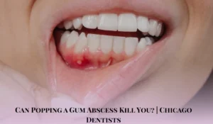 Can Popping a Gum Abscess Kill You