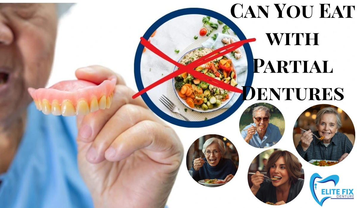Can You Eat with Partial Dentures