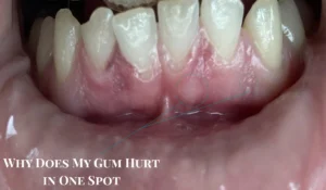 Why Does My Gum Hurt in One Spot