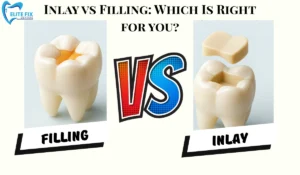Inlay vs Filling