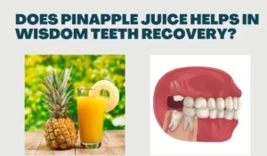 Pineapple Juice Wisdom Teeth