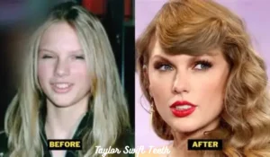 Taylor Swift Teeth