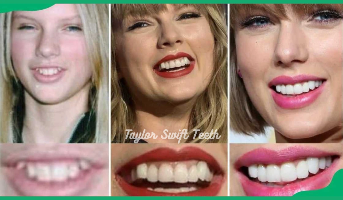 Taylor Swift Teeth
