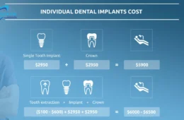 Dental Implants Cost in the USA (2026 Complete Guide)