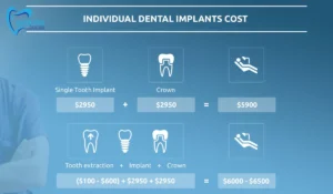 DENTAL IMPLANTS COST IN THE USA