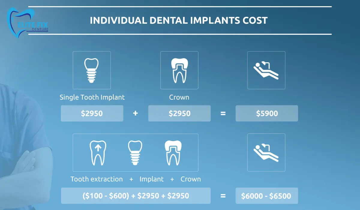 DENTAL IMPLANTS COST IN THE USA