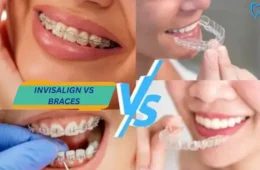 Invisalign vs Braces for Adults: Cost, Comfort & Results (2026)