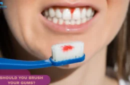SHOULD YOU BRUSH YOUR GUMS?