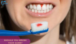 SHOULD YOU BRUSH YOUR GUMS