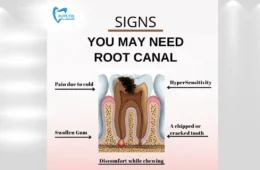 10 WARNING SIGNS YOU MAY NEED A ROOT CANAL