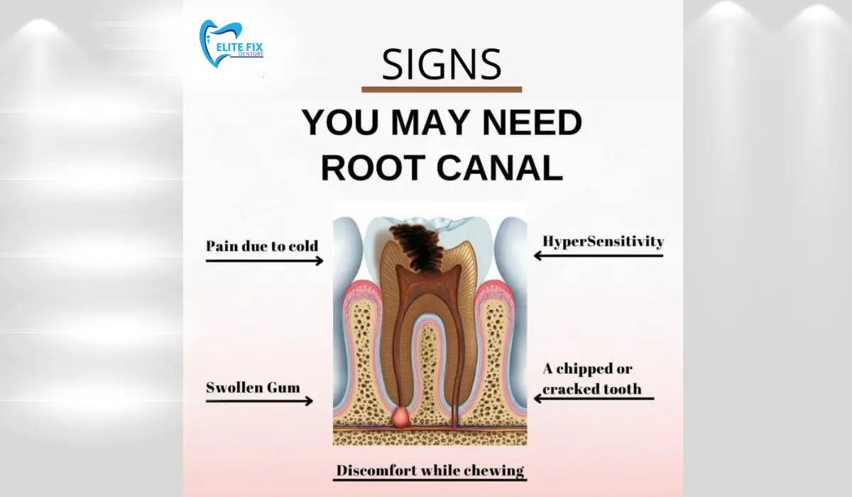 WARNING SIGNS YOU MAY NEED A ROOT CANAL
