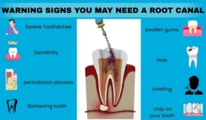 WARNING SIGNS YOU MAY NEED A ROOT CANAL