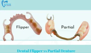 Dental Flipper vs Partial Denture