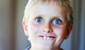 How to Fix Buck Teeth